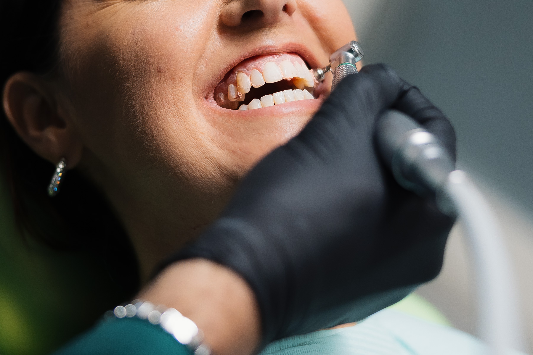 Igiene professionale e salute orale