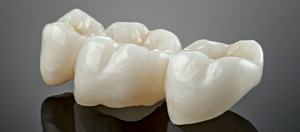 Protesi in Ceramica Metal Free
