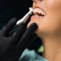 Cosa significa dentista convenzionato? Guida completa per i pazienti